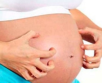 Что провоцирует кожный зуд у беременных и как с ним можно справиться
