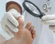 Как избавить ноги от грибка стопы: лечение проверенными методами