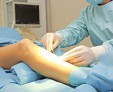 Почему появляются язвы на ногах, диагностика и методы лечения