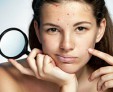 Какие бывают кожные заболевания на лице и причины появления