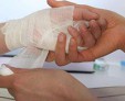 Заболевания, поражающие кожу на руках — как с ними бороться?