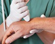 Хроническая экзема кистей рук — почему возникает это заболевание?