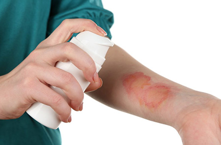 Проявления аллергического дерматита на коже в сложных случаях могут приобретать вид мокнущей экземы