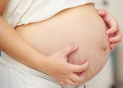 Чтобы беременность протекала без осложнения в виде дерматита, стоит уменьшить воздействие провоцирующих факторов на данный период времени