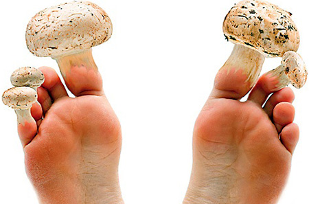 Возбудителем дерматофитии является грибок. Различные виды грибковых инфекций поражают кожные покровы и ногти.