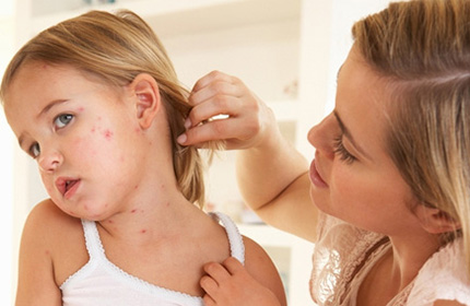 Подсыхание и заживление поврежденных кожных поверхностей является критерием для прекращения определенных терапевтических воздействий