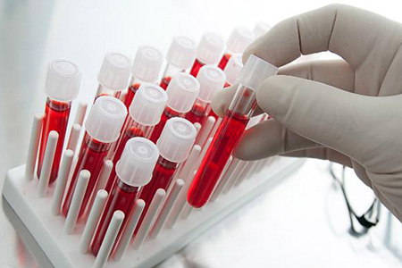 Один из ключевых этапов диагностики при эрозии - исследование крови