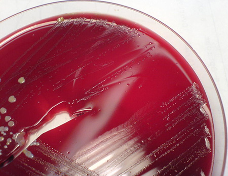 Выявить бактерии можно посредством проведения бакпосева крови