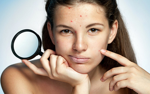 Воспалительные заболевания кожи лица характеризуются изменениями в волосяных фолликулах и сальных железах