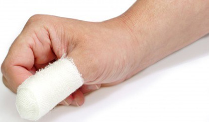 После проведения лечения суставного панариция важно иммобилизовать палец