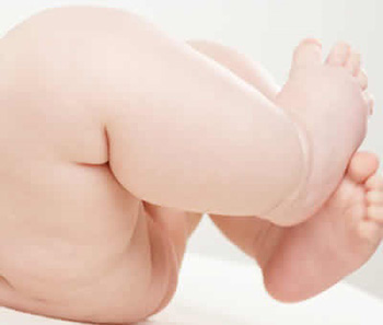 Ежедневные воздушные ванны для тела малыша – важное условие предупреждения потнички