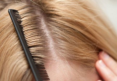 После каждой процедуры, направленной на подавление педикулёза, необходимо расчёсывать волосы