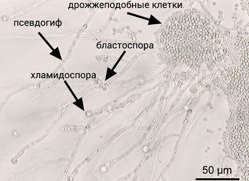 Строение вида Candida albicans, который наиболее распространен