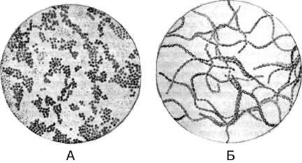 Микропрепараты с изображением А – стафилококков (группа шарообразных бактерий, расположенных в виде гроздей винограда), Б – стрептококков (группа шарообразных бактерий, расположенных в виде длинных цепочек)
