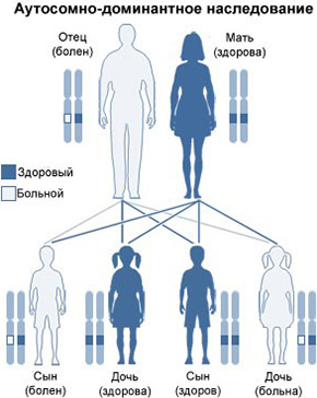 Вероятность рождения здоровых/больных детей при условии, если отец болен нейрофиброматозом (мутация в одной из двух хромосом), а мать полностью здорова