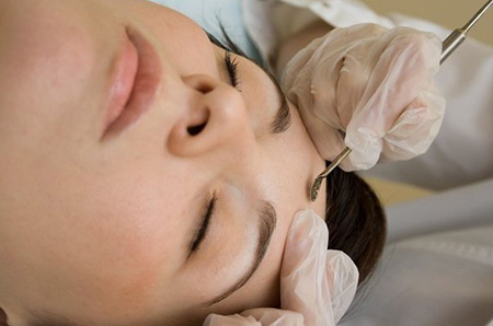 Механическая очистка кожи в косметологическом салоне – один из наиболее действенных методов для удаления белых угрей