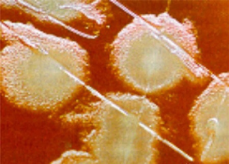 Так выглядят колонии (скопления) золотистого стафилококка под микроскопом
