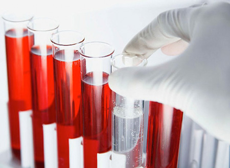 Анализ крови на герпес позволяет специалисту подобрать индивидуальное лечение