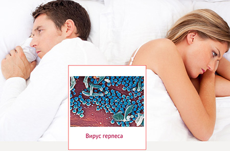 Вирус герпеса второго типа может активизироваться как в мужском, так и в женском организме