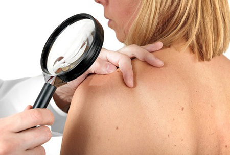 На фоне выраженных изменений поврежденного участка кожи обнаруживают дерматологическое заболевание