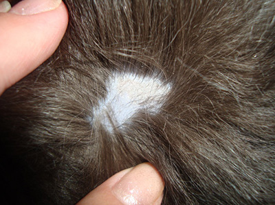 Стригущий лишай поражает волосистую часть головы