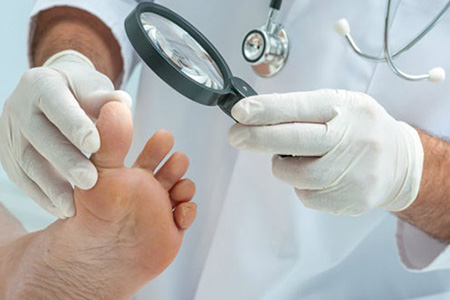 При первых же симптомах поражения ногтей нужно немедленно обратиться к врачу