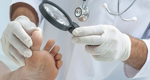 При запущенной форме недуга врач должен назначить комплексное лечение с учетом степени поражения ногтя