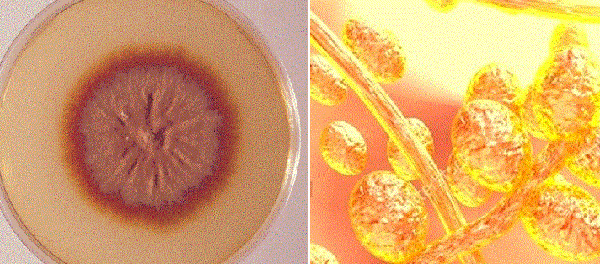 Красный трихофитон наиболее часто вызывает заболевание. Слева – колонии, справа – споры и мицелий (тело) грибка.