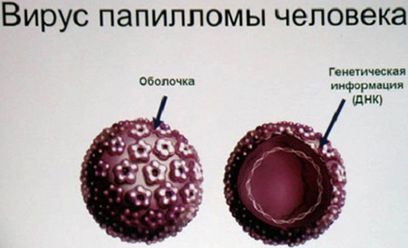 Так выглядит вирус папилломы человека, основной функциональный элемент которого – ДНК, изменяющая генетическую информацию клеток организма
