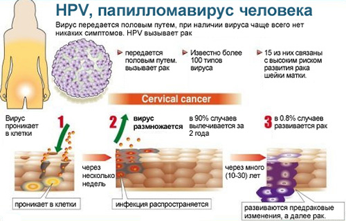 Основные характеристики папилломавируса человека