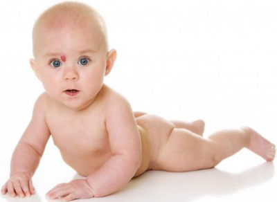 Родимые пятна у новорожденных чаще всего исчезают через некоторое время, но лучше показать малыша медику для уточнения природы невуса