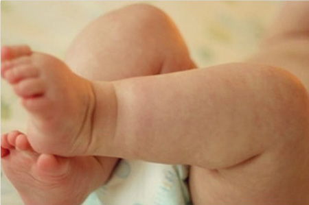 Высыпания на тельце малыша довольно часты, нужно быть особо внимательным, чтобы заметить первые их проявления