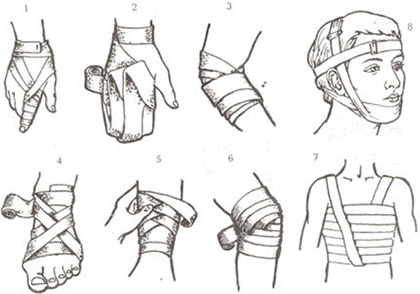 Наглядный пример видов повязок на различные части тела